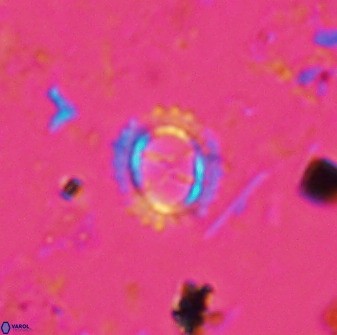 Rotelapillus tesserisbares 35853