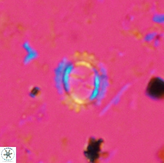 Rotelapillus tesserisbares 35853