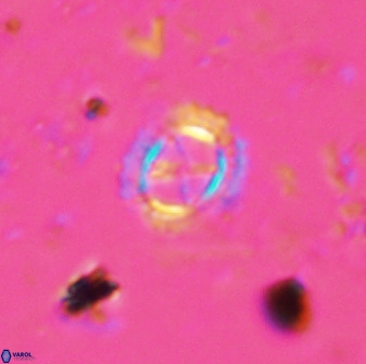 Rotelapillus tesserisbares 35855