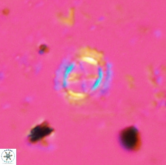 Rotelapillus tesserisbares 35855