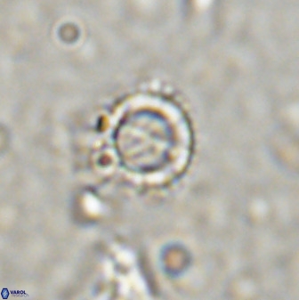 Rotelapillus tesserisbares 38307