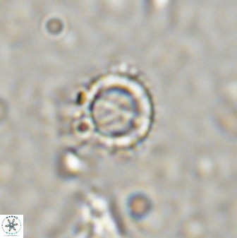 Rotelapillus tesserisbares 38307