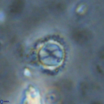 Rotelapillus tesserisbares 38304