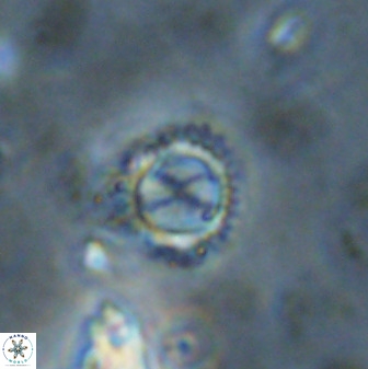 Rotelapillus tesserisbares 38304