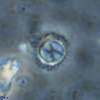 Rotelapillus tesserisbares 38305