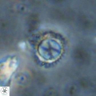 Rotelapillus tesserisbares 38305