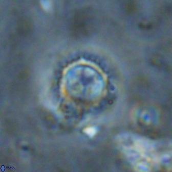 Rotelapillus tesserisbares 38306