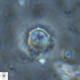Rotelapillus tesserisbares 38306