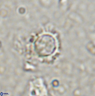 Rotelapillus tesserisbares 38308
