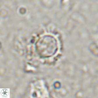 Rotelapillus tesserisbares 38308
