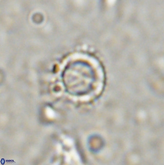 Rotelapillus tesserisbares 38309