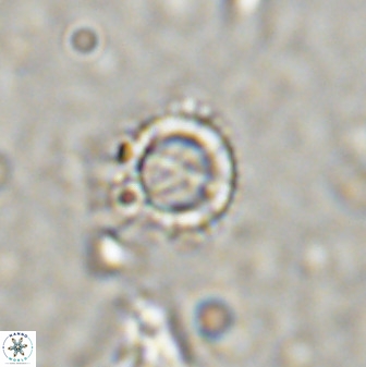 Rotelapillus tesserisbares 38309