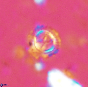 Rotelapillus tesserisbares 38313