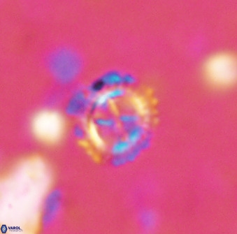 Rotelapillus tesserisbares 38314