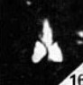 Furcatolithus ciperoensis 137