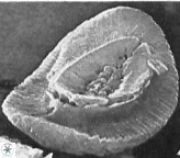 Helicosphaera dinesenii 1980