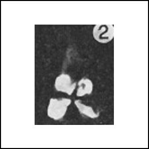 Sphenolithus heteromorphus 233a