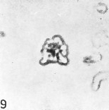 Sphenolithus moriformis S3a 21