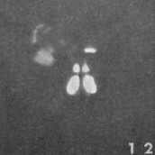 Sphenolithus spiniger 25827
