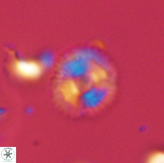 Scoteinimorfi aquilus 58825