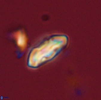 Scoteinimorfi aquilus 58830