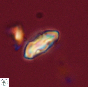 Scoteinimorfi aquilus 58830