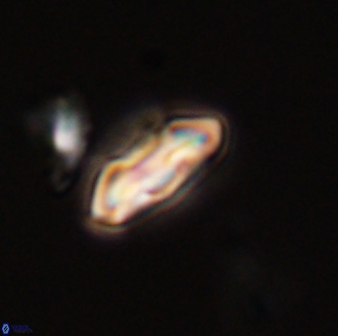 Scoteinimorfi aquilus 58831