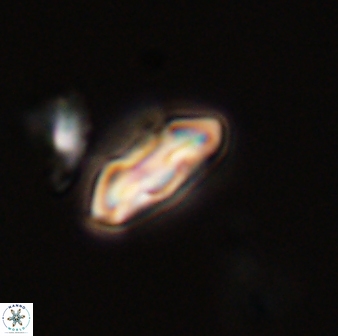 Scoteinimorfi aquilus 58831