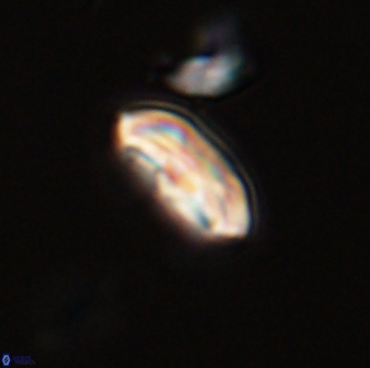Scoteinimorfi aquilus 58832