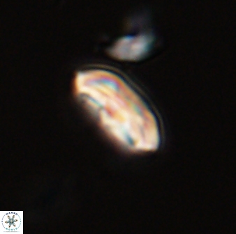 Scoteinimorfi aquilus 58832
