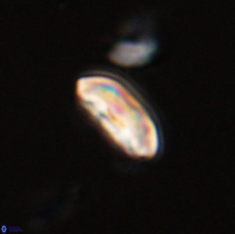 Scoteinimorfi aquilus 58835
