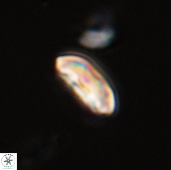 Scoteinimorfi aquilus 58835