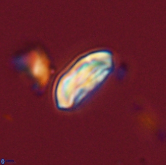 Scoteinimorfi aquilus 58838