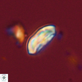 Scoteinimorfi aquilus 58838