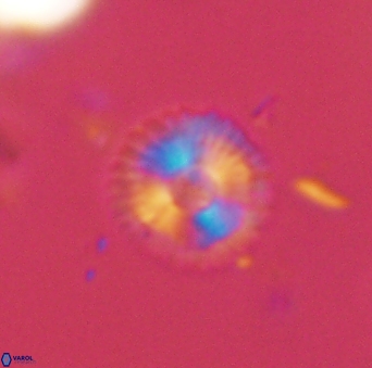 Scoteinimorfi aquilus 58994