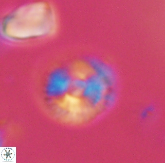 Scoteinimorfi aquilus 59020