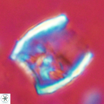Scyphosphaera apsteinii VR 08380