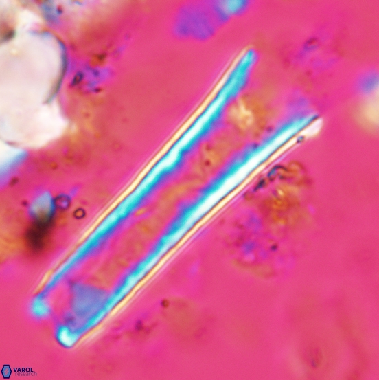 Scyphosphaera decedomurale 1985