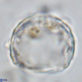 Scyphosphaera globulata VR 10242