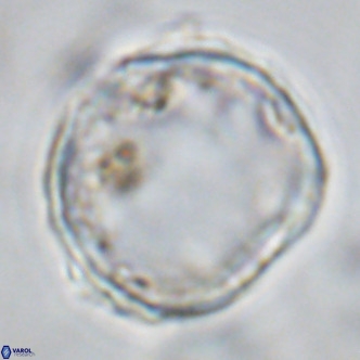 Scyphosphaera globulata VR 10243