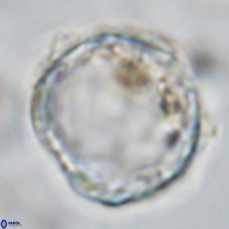 Scyphosphaera globulata VR 10245