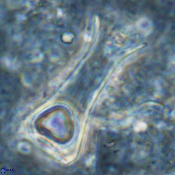 Scyphosphaera intermedia 48949