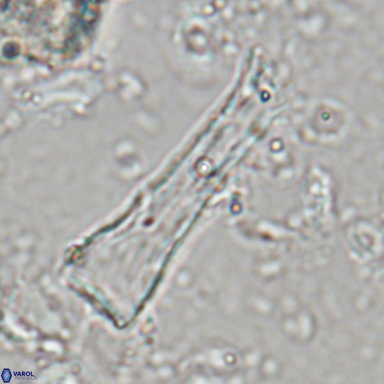 Scyphosphaera quasitubifera 22814