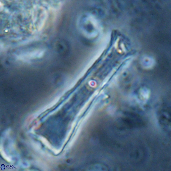 Scyphosphaera quasitubifera 22815