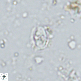 Sarmania partitum VR 15190