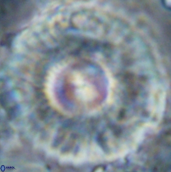 Senelia katapliktikos 22501