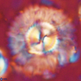 Senelia katapliktikos 59776