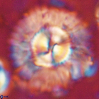 Senelia katapliktikos 59777