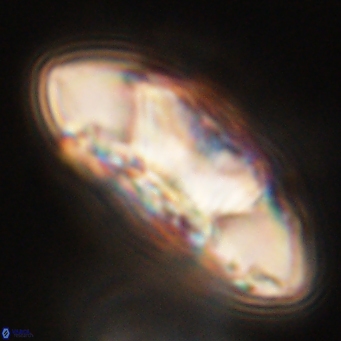 Senelia katapliktikos 67010