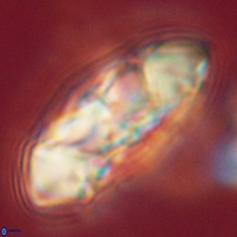 Senelia katapliktikos 67012